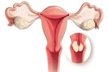 Fibroids - Do not ignore this seemingly harmless disease!