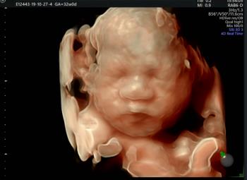 赤ちゃんを健康で安全にするために、胎児奇形超音波のために3つの目印を作成する必要があります