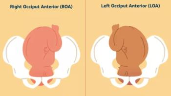 Analysis of fetal positions on the left side of the womb