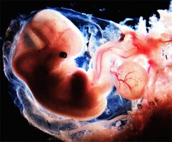 Expressões ao ter o embrião mais preciso que as mães grávidas precisam saber