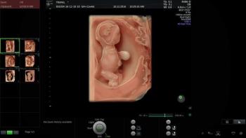 Hoe goed is de ontwikkeling van de geslachtsdelen van de 12 weken foetus? Is het mogelijk om precies te weten of een baby een jongen of een meisje is?