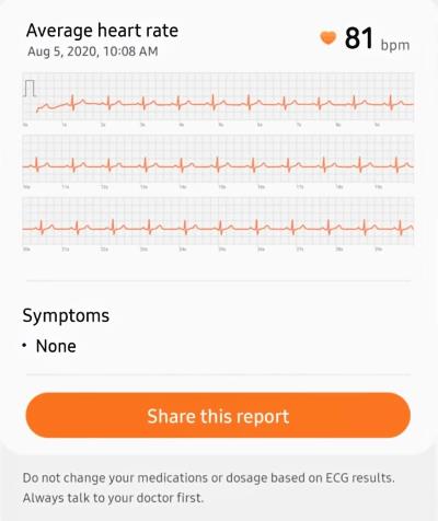 Jak sprawdzić EKG na Samsung Galaxy Watch