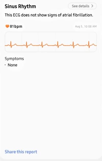 Comment vérifier l'ECG sur Samsung Galaxy Watch