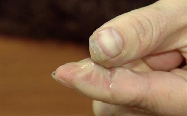 How to remove 502 glue on your hand in seconds