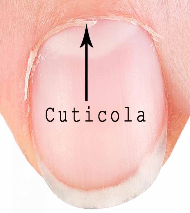 Cuticles: how to eliminate them and not make them grow back
