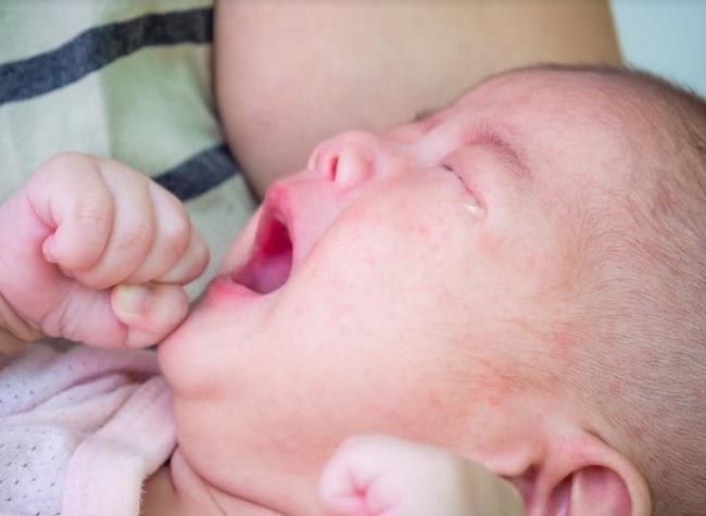 12 enfermedades comunes de los recién nacidos hacen que las madres se inquieten con los pañales