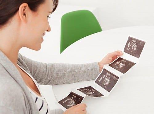 32 weken prenatale zorg - Belangrijke indicatoren van de moeder hebben speciale aandacht nodig