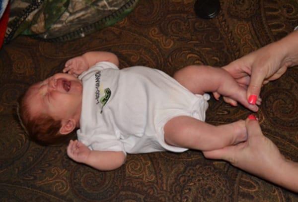 Is het proberen om de benen van een baby te manipuleren de moeder schade aan de baby?