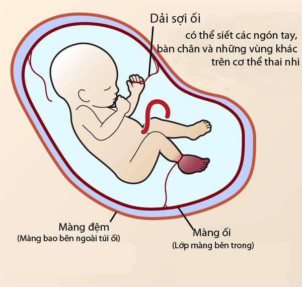 The cause of cleft palate and cleft palate is this!