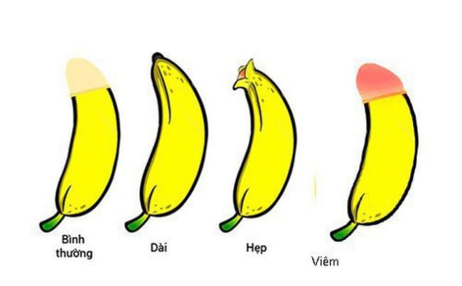 หนังหุ้มปลายลึงค์ตีบในเด็ก - เมื่อไหร่จะรุนแรง?