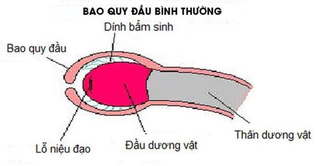 Stenosis kulup pada anak - kapan menjadi parah?