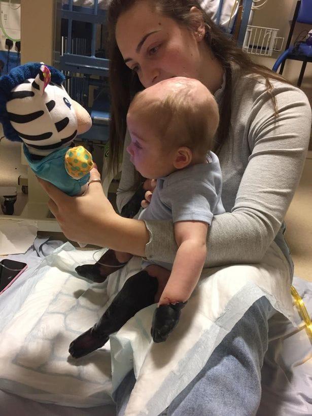 Der 11 Monate alte Junge verlor seine Arme und Beine aufgrund von Halsschmerzen