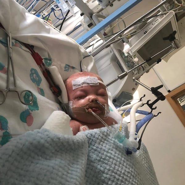 Un garçon de 11 mois a perdu tous ses membres en raison de complications d'un mal de gorge