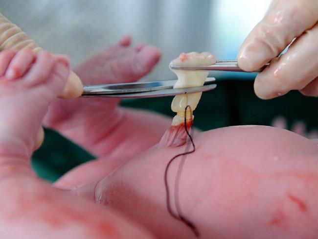 10 نکته در مورد ذخیره سازی خون بند ناف برای نوزادان بدانید