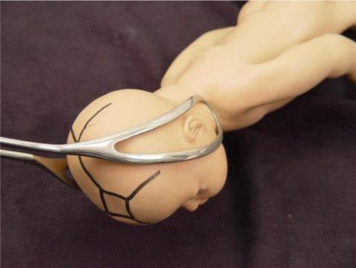 Using suction at birth - Risks you may face!