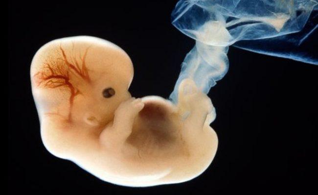 Ultraschall des Fetalsacks, aber nicht festgestellt, dass der Embryo Anzeichen einer Fehlgeburt hat?