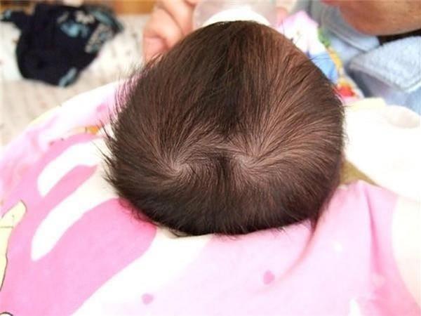 How many hair whorls does your baby have?  Let's see what whirlpool says about a child's personality and future