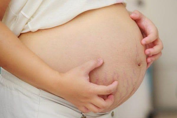Die Unterscheidung zwischen Bauchfett und schwangerem Bauch hilft Frauen am leichtesten zu erkennen