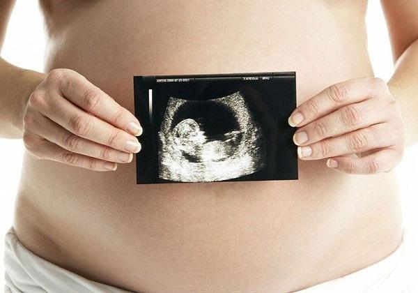Abnormaal pedaal van de foetus: Waarschuwing voor zwangere vrouwen is mogelijk doodgeboorte
