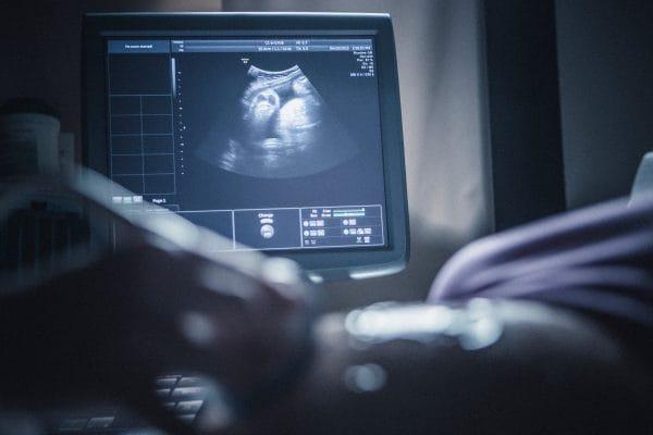 Mamele însărcinate nu trebuie să ignore aceste 4 repere importante cu ultrasunete fetale!