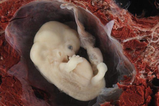 Photos of 8 weeks old fetus - Where has the tail gone?