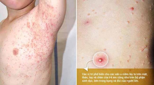 What is a baby with a non-itchy rash?  Is there a way to treat it thoroughly?