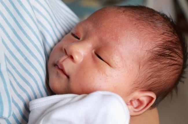 O que é um bebê com erupção na pele que não coça?  Existe uma maneira de tratá-lo completamente?