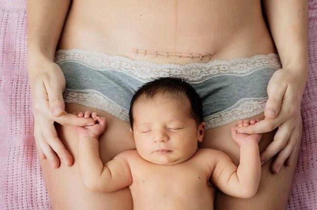 بارداری سوم بعد از 2 سزارین ، مادر برای ایمن نگه داشتن جنین چه کاری باید انجام دهد؟