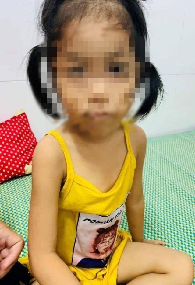 3-месячный ребенок был отравлен, его сердце было шокировано, потому что семья использовала этот препарат, чтобы уронить нос
