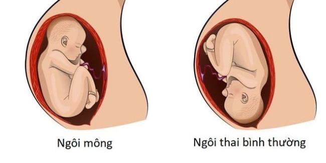 W jakiej pozycji znajduje się płód w 8. miesiącu, który jest korzystny dla normalnego porodu?