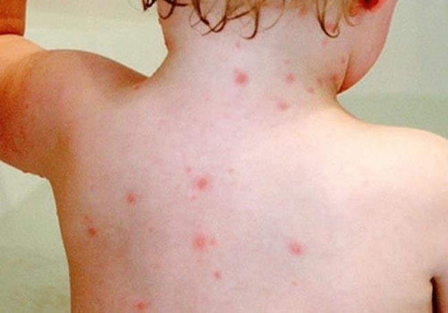 Your baby has a red rash on his face - What is it?