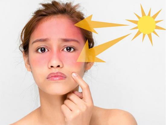 Bahaya sinar ultraviolet pada mata, kulit mata dan cara memilih cermin mata pelindung