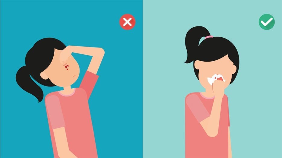 O que é a doença do sangramento nasal espontâneo? O que é a doença do sangramento nasal espontâneo?