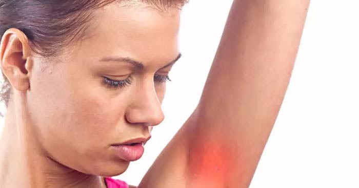 Is armpit itching a warning sign of cancer? Is armpit itching a warning sign of cancer?
