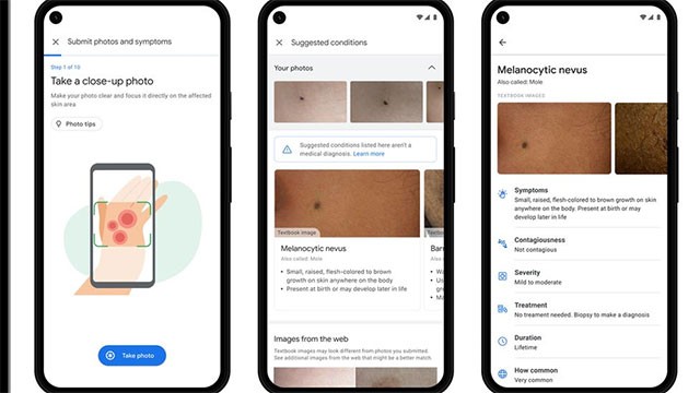 Google desenvolve algoritmo de IA que pode diagnosticar doenças de pele e tuberculose Google desenvolve algoritmo de IA que pode diagnosticar doenças de pele e tuberculose